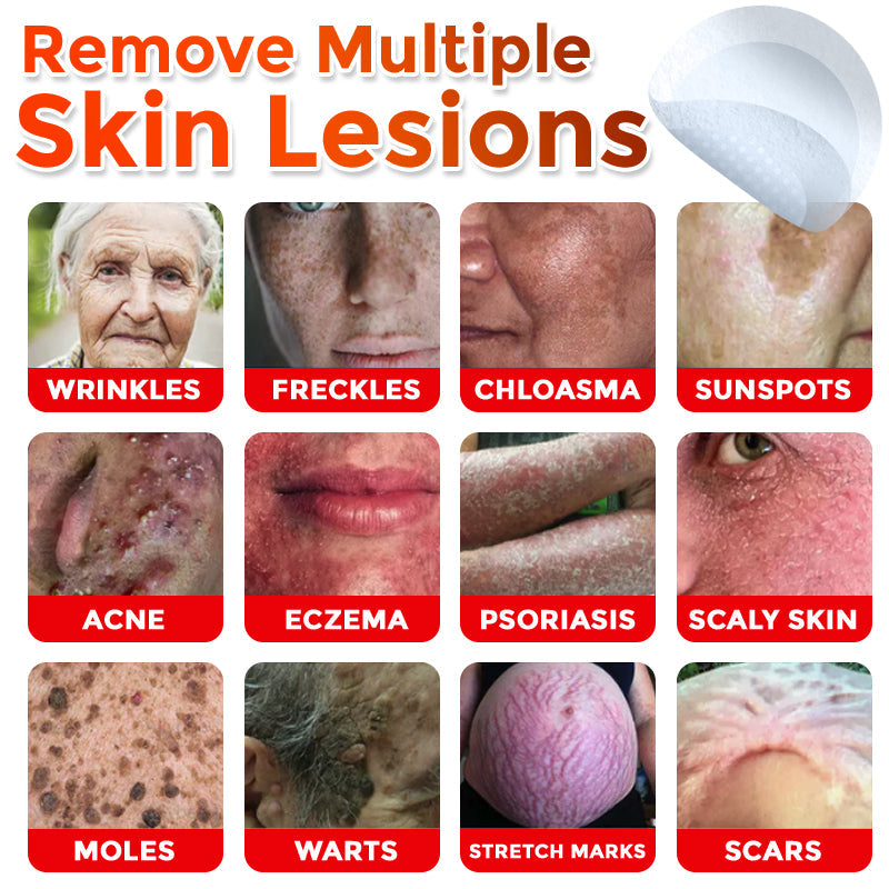 💥Solaroza® MicroNeedle Botanic Skin Patch – Safe & Effective against Skin Tags, Warts & Moles! ✨ Limited time only: Save 80% now (USA).